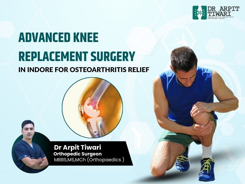 Knee replacement surgery in Indore performed by Dr. Arpit Tiwari for advanced Osteoarthritis treatment in Indore