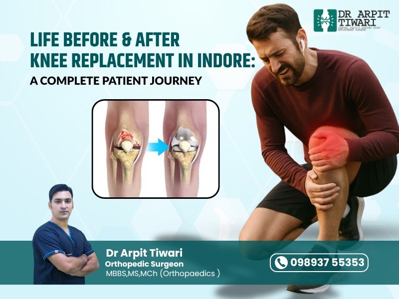 Life before and after knee replacement in Indore showing improved mobility and pain relief after surgery